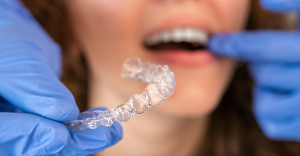 Cómo prevenir la acumulación de bacterias en retenedor