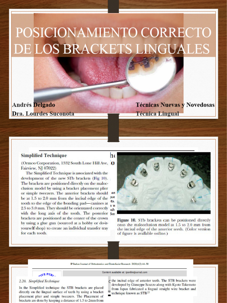 Cepillos y Herramientas Esenciales para Brackets Linguales