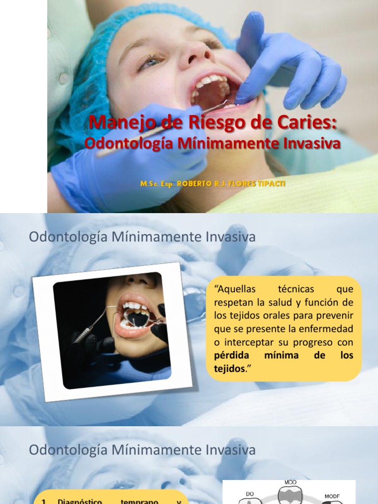 Entendiendo el Riesgo de Caries en Adultos Jóvenes