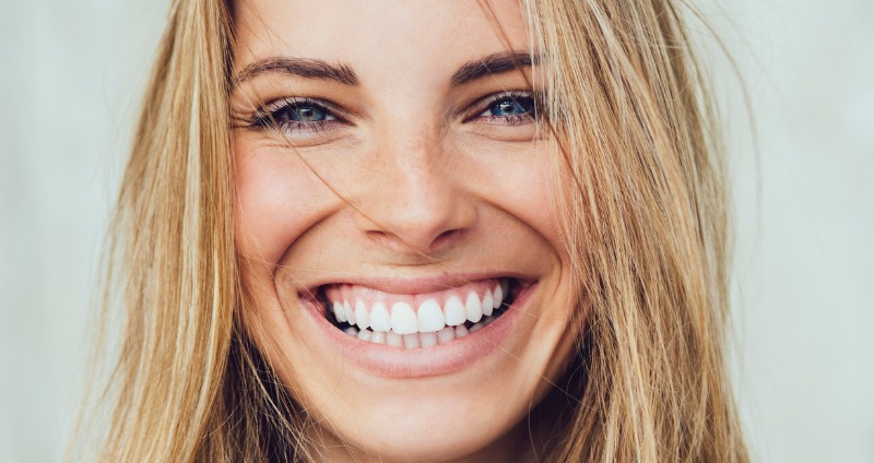 Tratamientos profesionales para una sonrisa más blanca