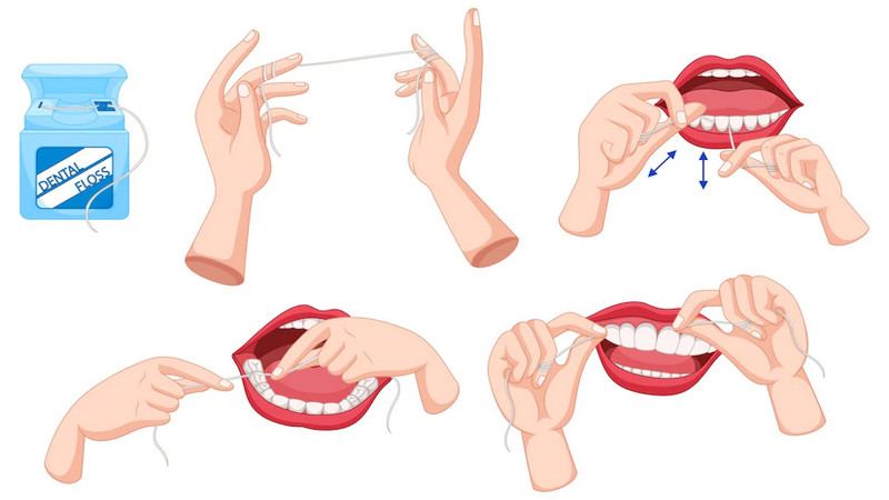 Uso del Hilo Dental: Un Complemento Indispensable