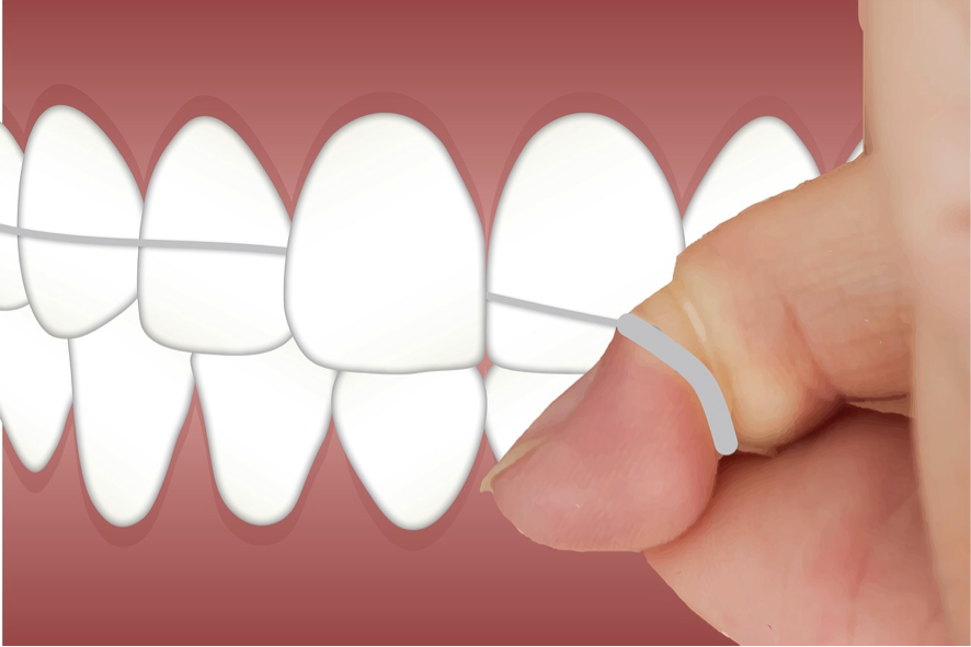 El Uso del Hilo Dental y Otros Complementos