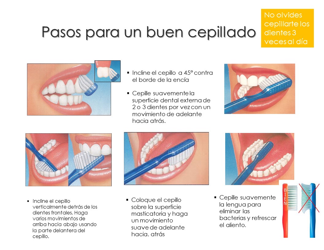 La base: Un cepillado correcto y constante
