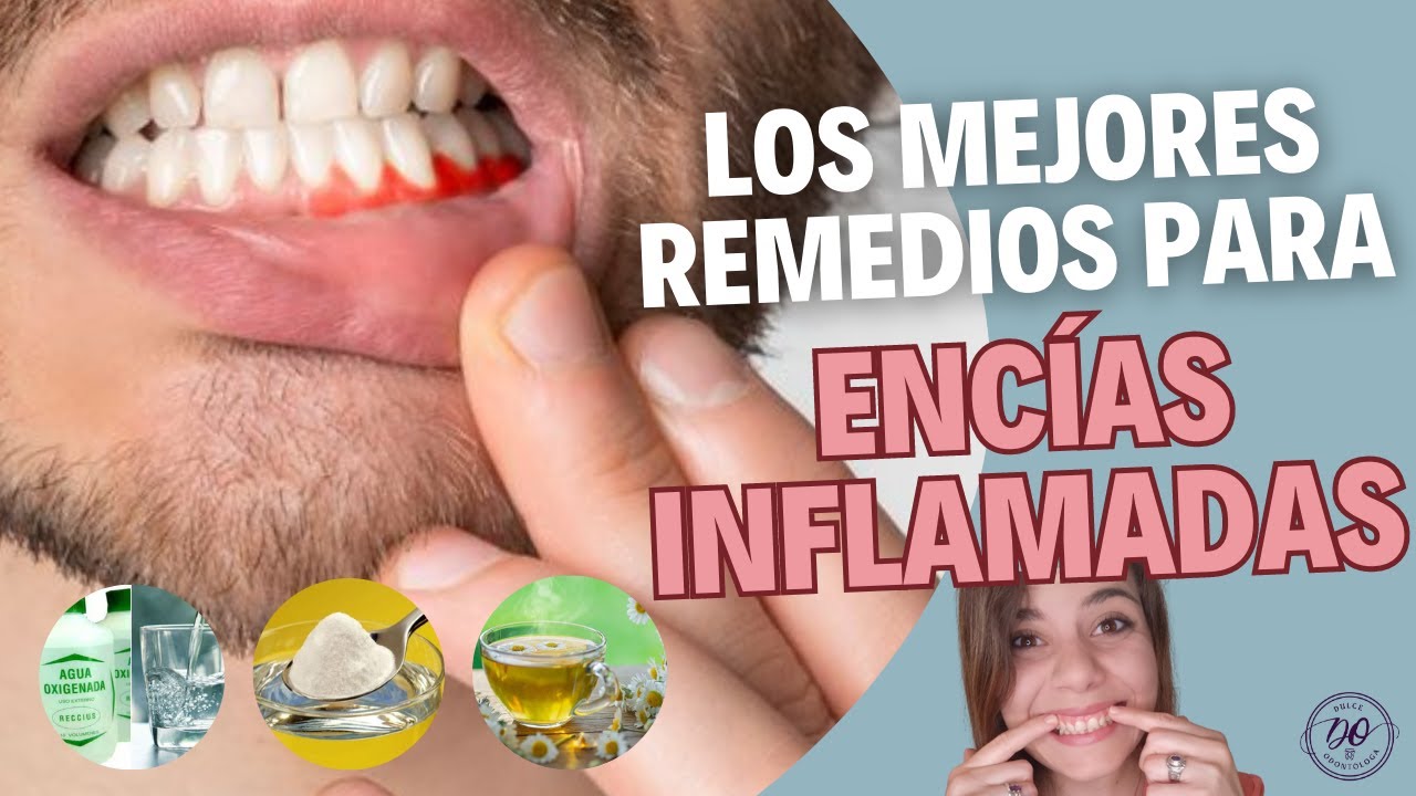 Más allá de los dientes: El cuidado de las encías