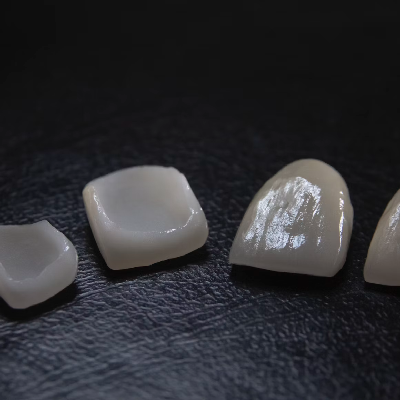 Retenedores: La clave para una sonrisa duradera