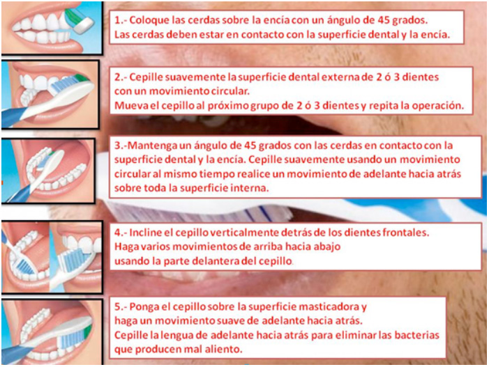 Técnicas de cepillado correctas