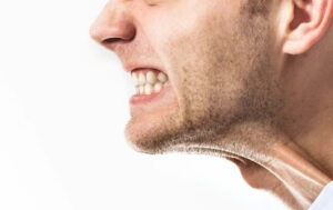 Bruxismo por qué aprietas los dientes por la noche y cómo tratarlo